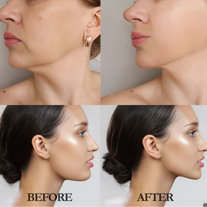 3D Lifting V-Line Mask